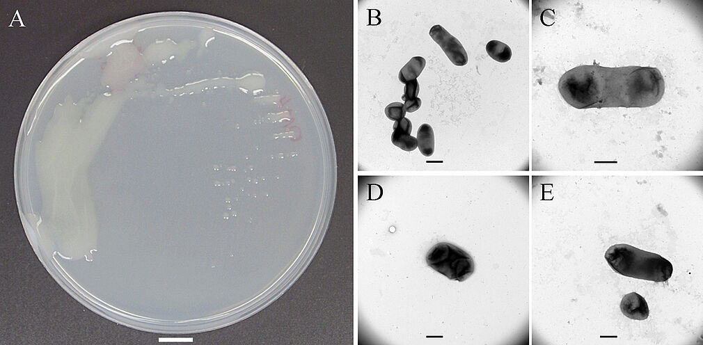 Kolonien und Zellen vom neu isolierten Stamm OM4 von Mesorhizobium onobrychidis: (Abb. A) OM4-Kolonien auf Nährmedium im Maßstab 100 mm; (Abb. B-E) Transmissionselektronenmikroskopische Aufnahmen von OM4-Zellen im Maßstab 1 μm in Abb. B, sowie 500 nm in Abb. C-E. © S. Ashrafi/JKI
