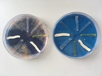 The two images show bacterial isolates on agar plates on which their production of protease (white), beta-1,3-glucanase (black dots) and cellulase (blue) is studied (Andrea Braun-Kiewnick, JKI)