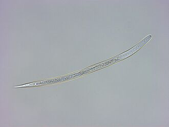 Microscopic image shows the worm-like body of Globodera pallida