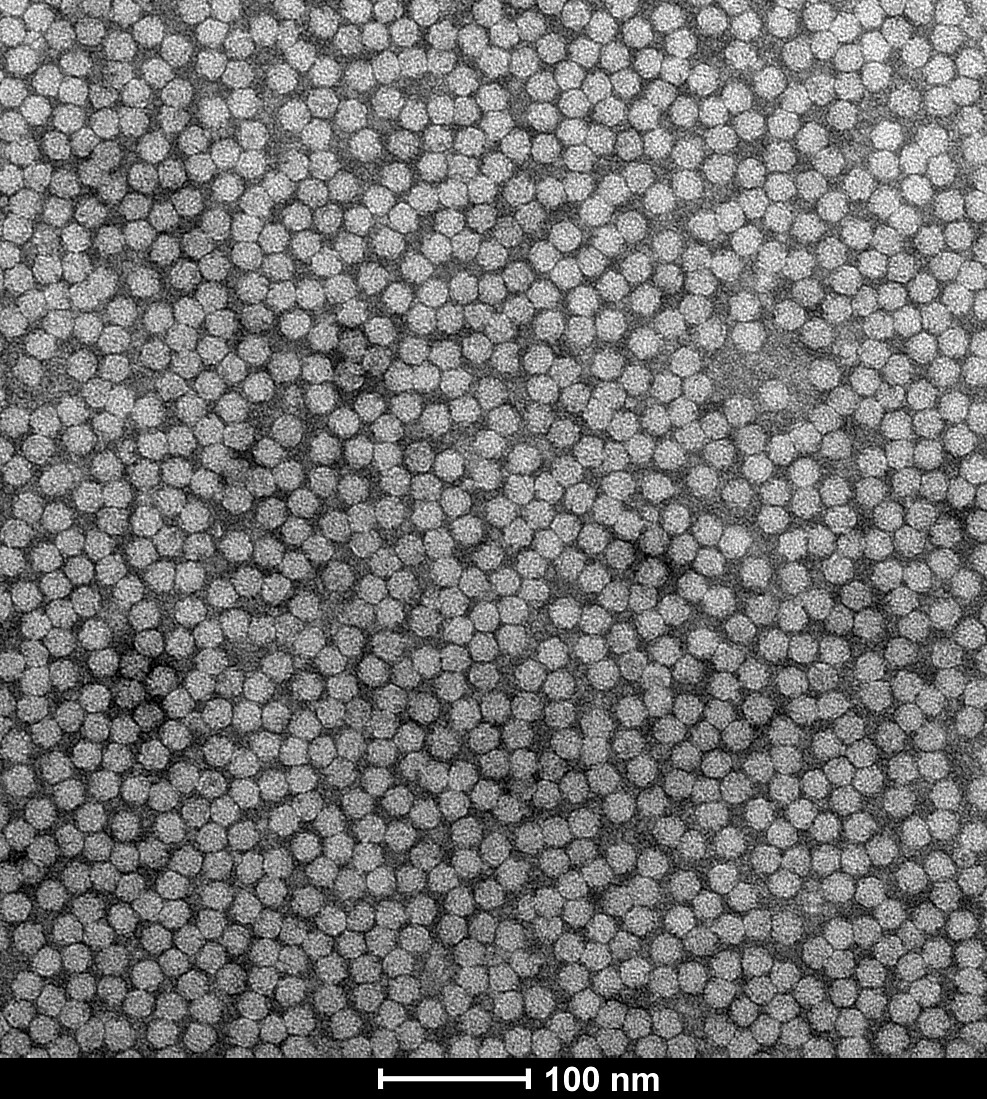 Elektronenmikroskopische Aufnahme von Nanovirus-Partikeln, 52.000-fache Vergrößerung. ©Katja Richert-Pöggeler/JKI