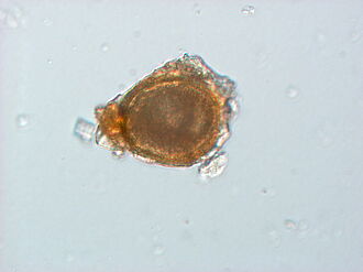 Microscopic image shows the round structure of the fungi spore.