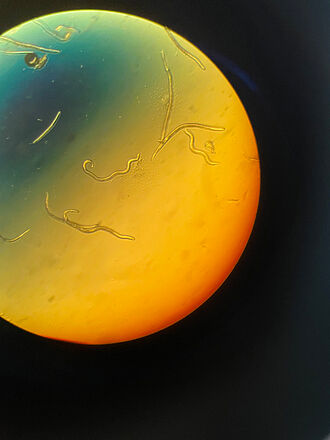 Das Foto zeigt den Blick durch ein Mikroskop auf Fadenwürmer aus einer Bodenprobe. Foto: Sarah Barnert/JKI